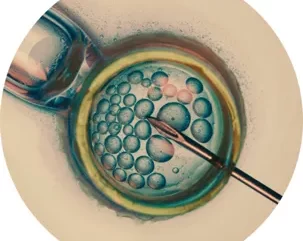 IVF Does Not Guarantee a Baby